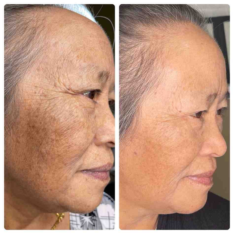 Lotus Skin Before & Afters