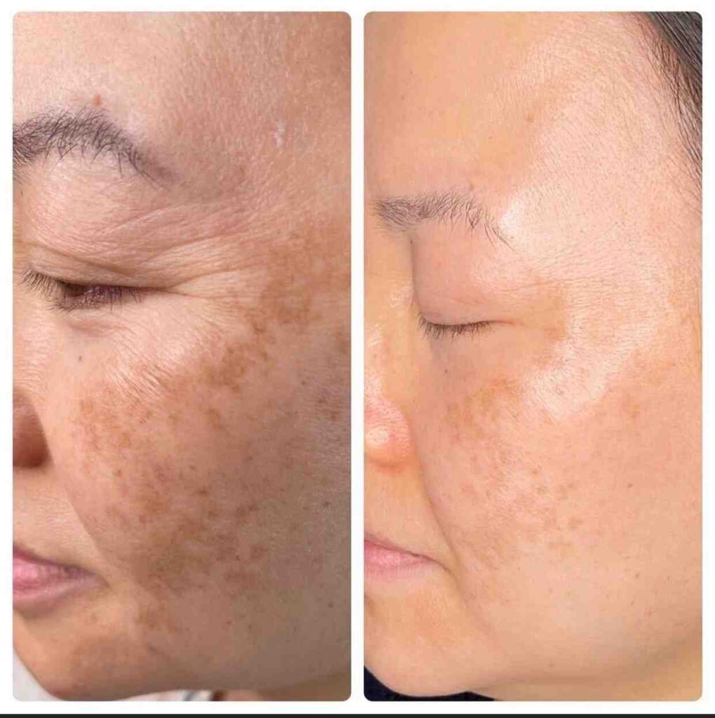 Lotus Skin Before & Afters