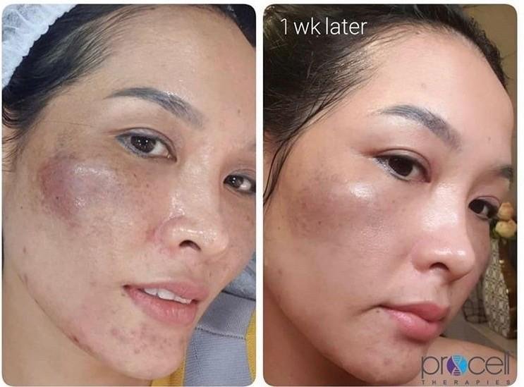 Lotus Skin Before & Afters